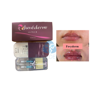 입술 증진을 위한 Voluma Hyaluronic 산 피부 충전물 Fosyderm