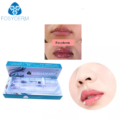 얼굴 Lip 24 마그네슘 / Ml을 위한 투명 젤 히알루론산 피부 필러