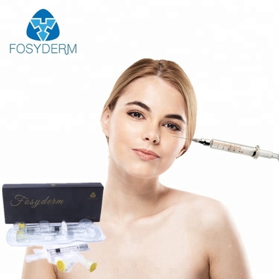 성형 수술 Derm 1ml를 위한 Fosyderm 나트륨 Hyaluronic 산 피부 충전물