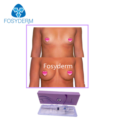 Fosyderm 10ml Hyaluronic 산 피부 충전물 둔부 및 유방 확대 주입