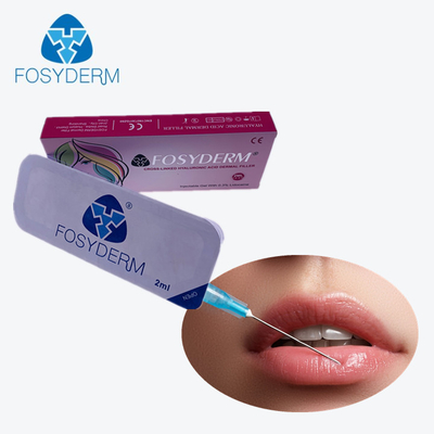 입술과 중간 주름을 위한 2개 Ml Fosyderm Derm 히알루론산 피부 충전물