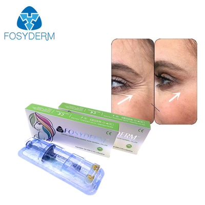 Fosyderm Dermal Fine Line Filler Eyes Anti Wrinkles HA Filler (포시더름 피부 얇은 선 필러 주사기)