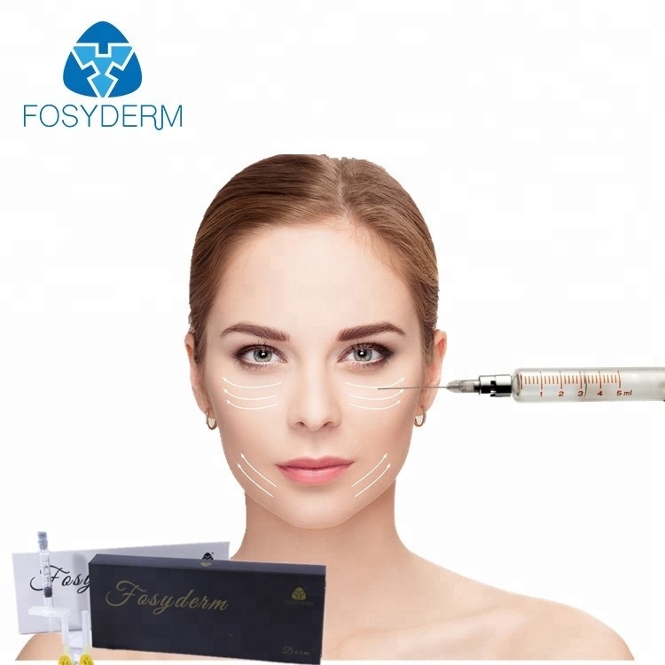 성형 수술 Derm 1ml를 위한 Fosyderm 나트륨 Hyaluronic 산 피부 충전물