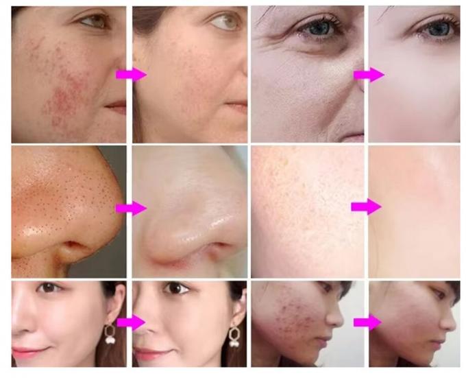얼굴 메신저 얼굴 청소기 주름 방지 물 산소 제트필 3