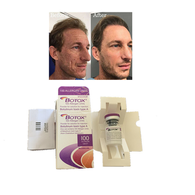 Allergan  100 단위 유형 보툴리눔 독소 주사 주름 방지