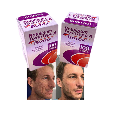 보톡스 주사 분말 Allergan 화장품 노화 방지 주름 100 단위