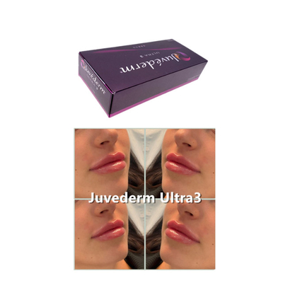 2ml 히알루론산 피부 필러 Juvederm Volume For Anti Aging Ultra3 Ultra4