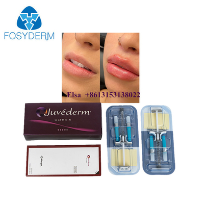 Juvederm 주사용 피부 필러 Juvederm Ultra3