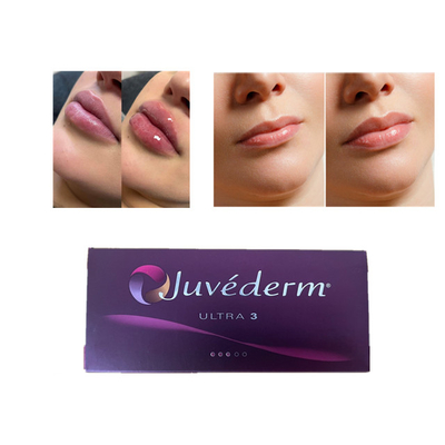 Juvederm 히알루론산 피부 필러 안티 링클 페이셜 립 필러