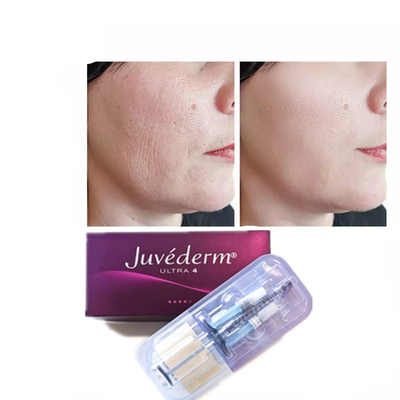 Juvederm 히알루론산 피부 필러 노화 방지 2*1ml 얼굴 필러