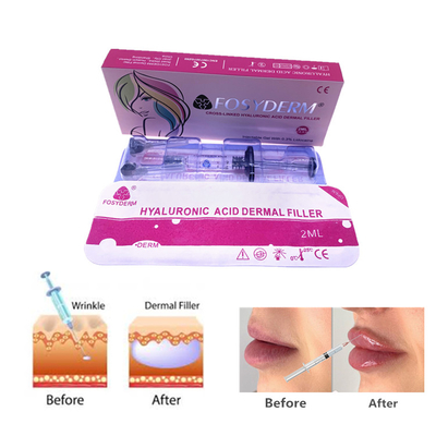포시더름 2ml 히알루론산 젤 피부 필러 주사 얼굴 코 피부 관리
