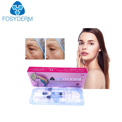 OEM 힐루론산 피부 필러