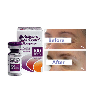 주입당 100개 Botulinum Toxin 냄새 없는 및 전문적인 강도 주입