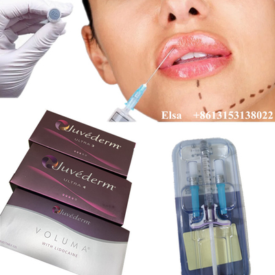 Juvederm Ultra4 볼루마 피부 필러 안티 주름 얼굴 히알루론산 주입