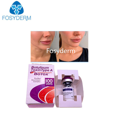 A Type A 100 단위 Allergan Botulinum Toxin Dermal Filler Hyaluronic acid