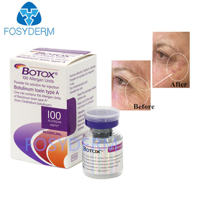 A Type A 100 단위 Allergan Botulinum Toxin Dermal Filler Hyaluronic acid