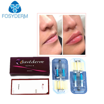 juvederm hyaluronic acid 피부 필러 얼굴에 주름 지정 주입