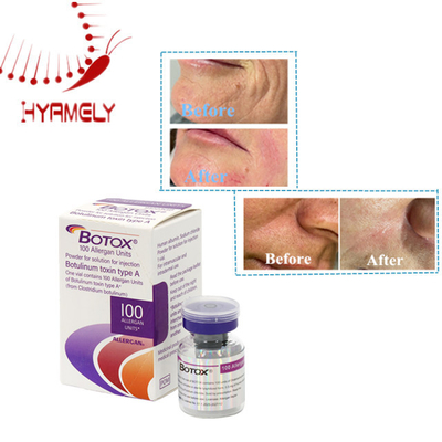 효과적 인 피부 관리 Botulinum Toxin 100 유닛 파우더 알레르기 항원 주입