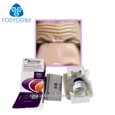 Pure Hot Dermal Fillers  Anti Facial Wrinkles Botulinum Toxin 100 Units