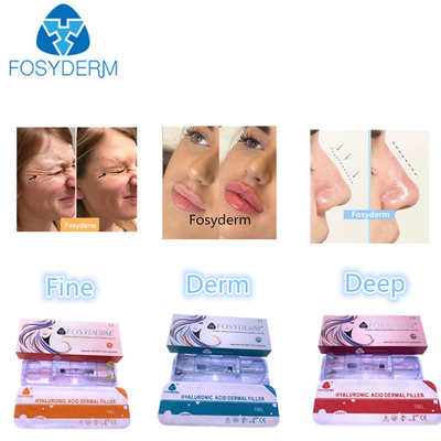 히알루론산 피부 필러 1ml-50ml 얼굴 및 신체