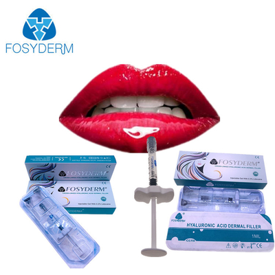 안면 및 바디 1ml 2ml 5ml 10ml 20ml 50ml에 대한 Fosyderm HA 필러 주입