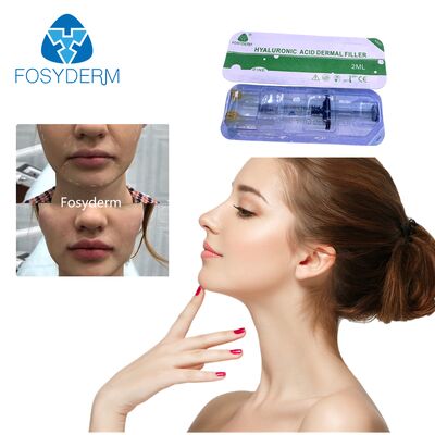 Hyaluronic Acid Dermal Filler for Facial Elegance and Lip Enhancement Injection
