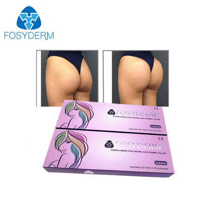 Fosyderm 필러 교차 연결 피부 필러 히알루론산 2ml 깊이 주입