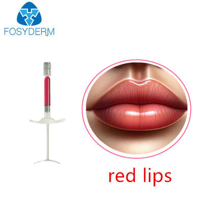 1ml 빨간 입술 충전물 히알루론산 주사 가능한 피부 충전물