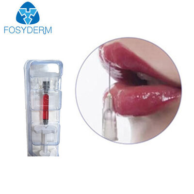 1ml 빨간 입술 충전물 히알루론산 주사 가능한 피부 충전물