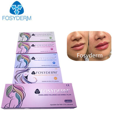 히알루론산 피부 필러 안티 주름 얼굴 리프팅 1ml 2ml