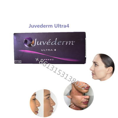 입술 충만 Juvederm Ultra4 Allergan 피부 충전물 Juvederm HA 충전물 For 입술
