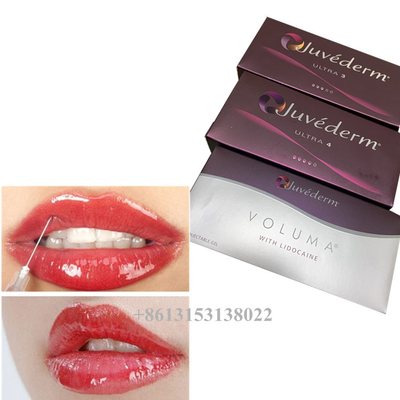 Juvederm Voluma 히알루론산 피부 필러 젤 24mg/Ml 피부 필러