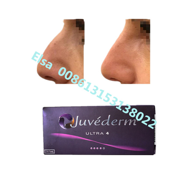 주베더름 나트륨 울트라4 볼륨 피부 필러 입술 턱 증강
