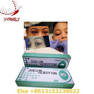 눈을 위한 1개 Ml 나트륨 Hyaluronate 젤 반대로 어두운 원형 피부 충전물