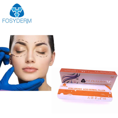화장용 주입을 위한 오래 견딘 Fosyderm Hyaluronic 산 피부 충전물