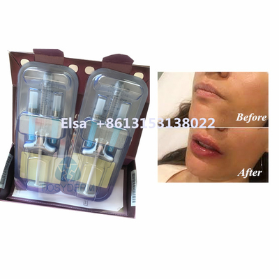 뷰티 제품 Juvederm Voluma 히알루론산 얼굴 필러 HA 주입
