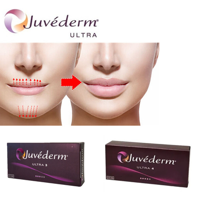 Juvederm Ultra3 Hyaluronic Acid Filler For Lips 피부 주입 젤 선충분