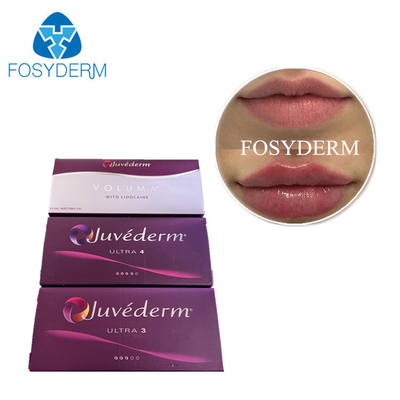 Juvederm 피부 필러 주사 수축 히알루론산 HA 젤 얼굴 필러 선충 주사