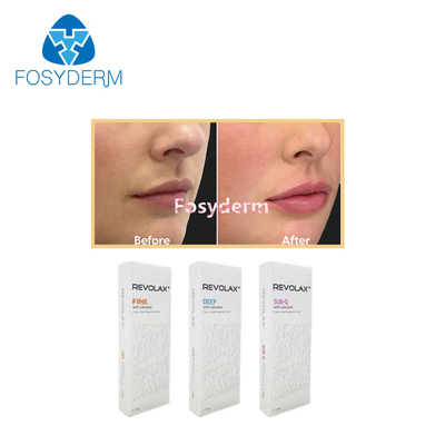 1.1ml 피부 립 필러 Revolax Fine Deep Sub-Q Anti Wrinkles 히알루론산 주입