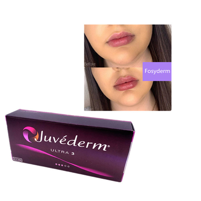 2ml Juvederm 히알루론산 피부 필러 주름 필러 턱 립 울트라 3