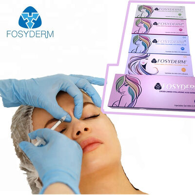 Fosyderm Hyaluronic Acid 얼굴 필러 피부 필러 주입