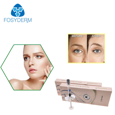 Fosyderm 십자가는 눈 주름을 위한 HA 충전물 2ml 단서 Hyaluronic 산을 연결했습니다