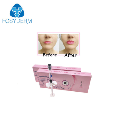 입술 코 Chin 충만은 HA Hyaluronic 산 주사 가능한 충전물 24mg/Ml를 교차 결합시켰습니다