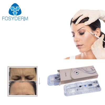 전 입술 충만 Fosyderm 채워진 교차 결합된 충전물