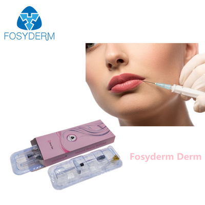 1 밀리람베르트 2 밀리람베르트 주사 가능한 교차하는 연결된 Lip 피부 필러 주름살 제거 주입