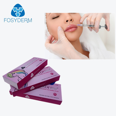 LIP 향상을 달성하기 위한 교차하는 연결된 HA 피부 필러 2Ml 진피는 주입합니다