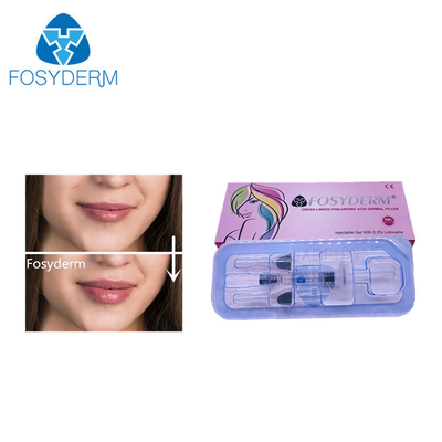 2ml 필러 히알루론산 피부 필러 얼굴 코 립 확장 24mg/ml