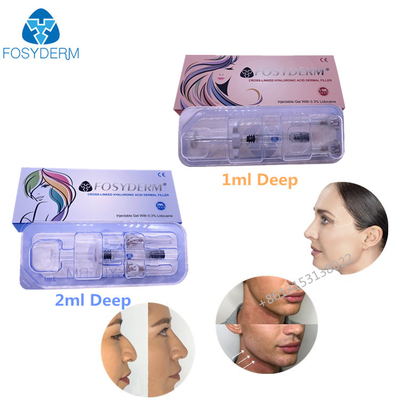 입술 얼굴 피부를 위한 교차 연결되는 주사 가능한 히알루론산 젤 피부 충전물 1ml 2ml