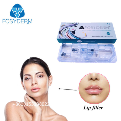 Fosyderm 1ml 히알루론산 피부 필러 주사술 입술 크기를 늘리기