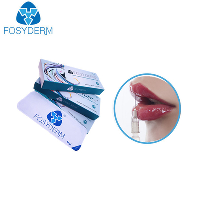 리도카인을 가진 1.1 Ml Derm 히알루론산 충전물 입술 증진 24 Mg